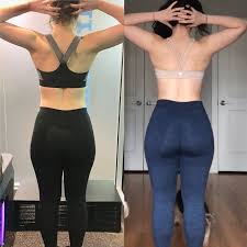 hip dips before and after